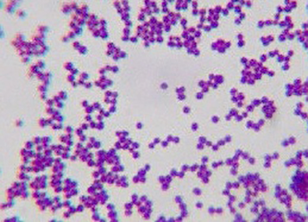 1 Staphylococcus epidermidis