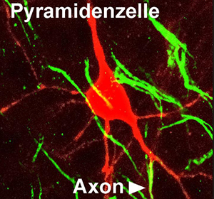 axon