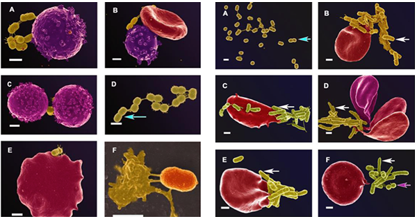 Mikrober i blodet - Foto: Marnie Potgieter, Janette Bester, Douglas B. Kell and Etheresia Pretorius