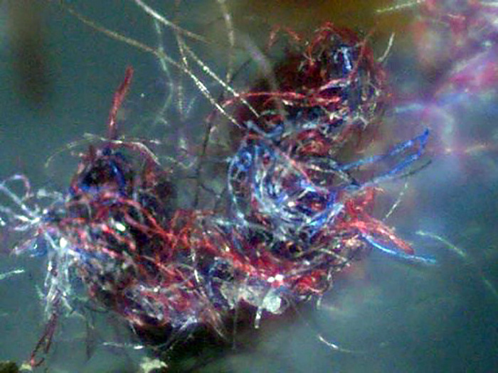 Foto på påstådda fibrer genererade av morgellons sjukdom. Fotokälla okänd.